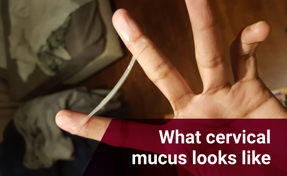 What cervical mucus looks like